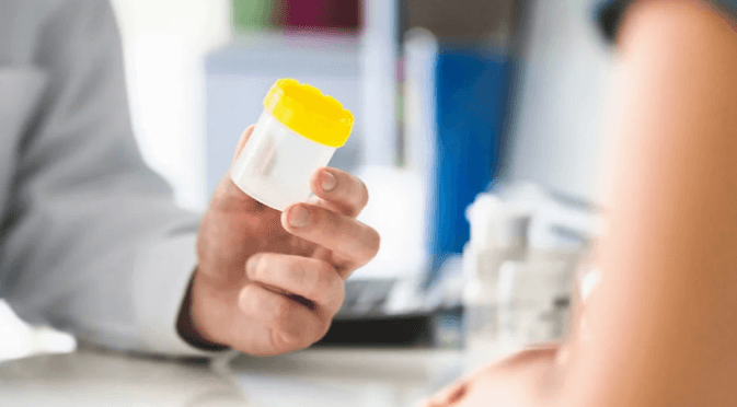 Does Cbd Cream Show up on Drug Tests Dot