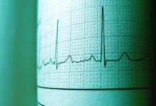cbd and heart rate