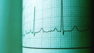 cbd and heart rate