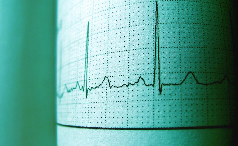 cbd and heart rate