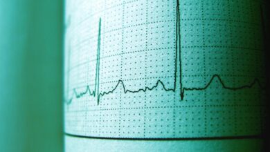cbd effects on heart rate