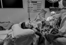 cbd use post surgery timing